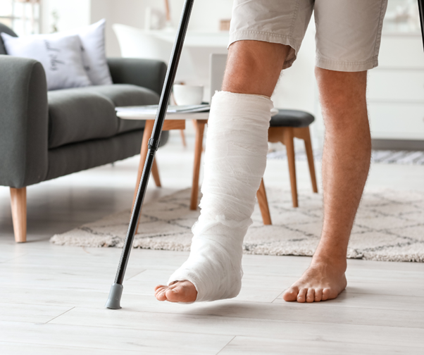 Person mit Gips am Bein und Krücken steht in einem Innenraum. Dieses Bild zeigt ein typisches Symptom der Hypophosphatasie (HPP): wiederkehrende Knochenbrüche, besonders in den unteren Gliedmaßen.